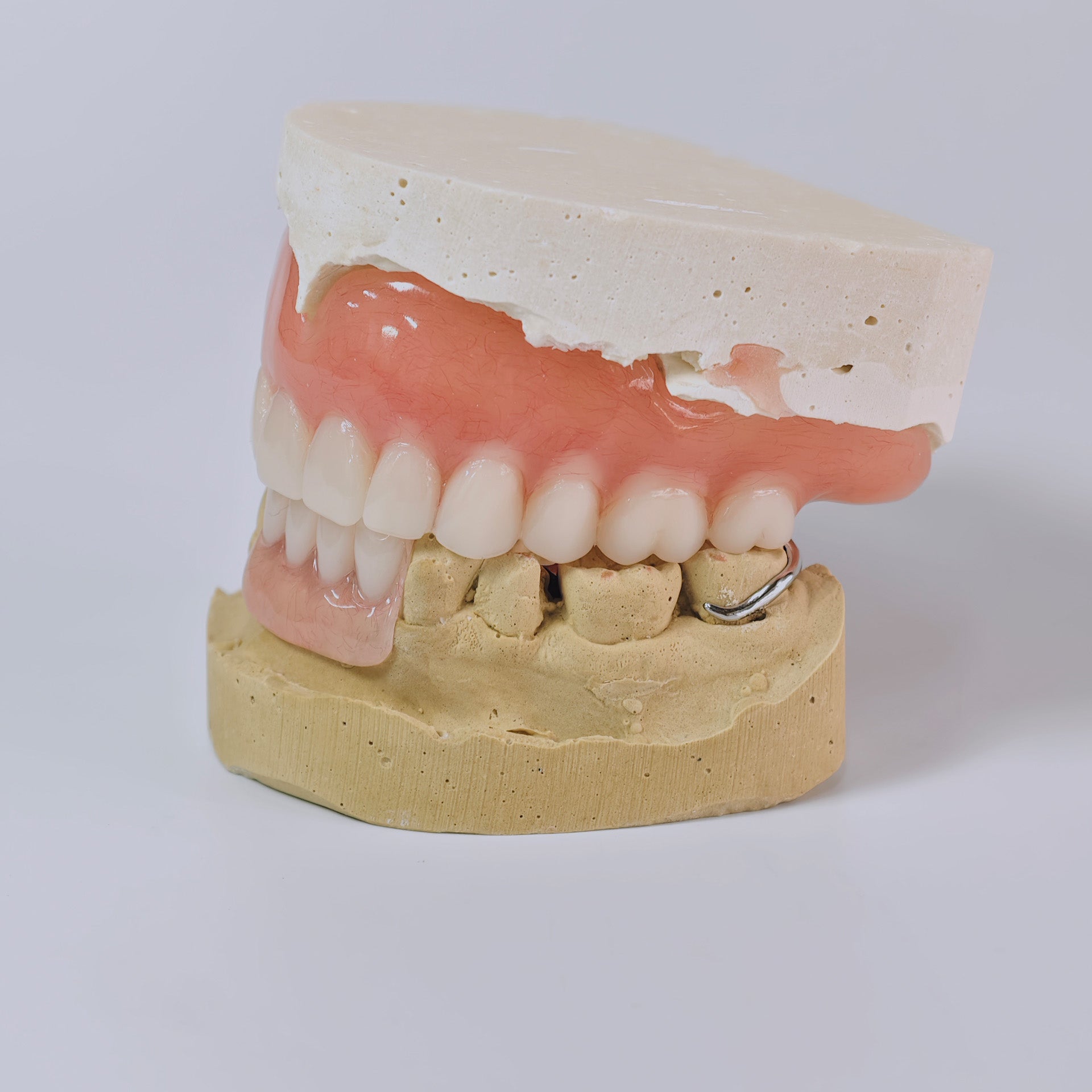 Full-Mouth Acrylic Denture