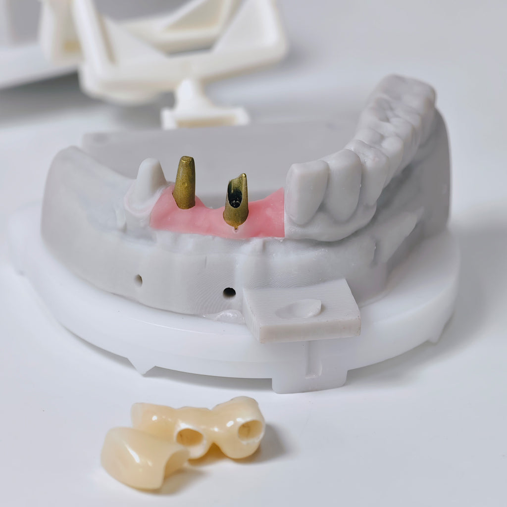 Full-Zirconia Crown And Bridge With Cement Retained And Co-Cr Frame Partial Denture