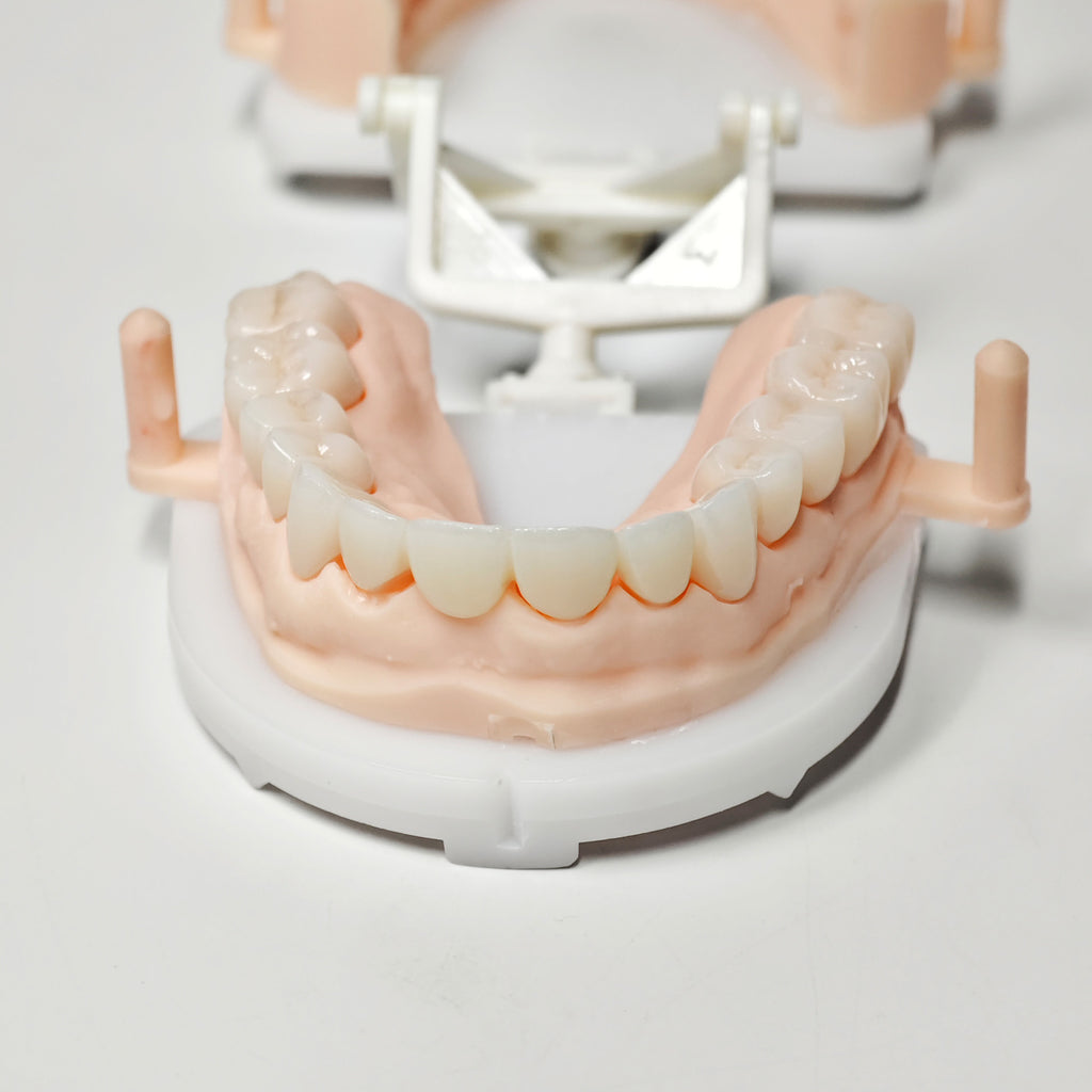 Full-Zriconia Crowns With Cement-Retained