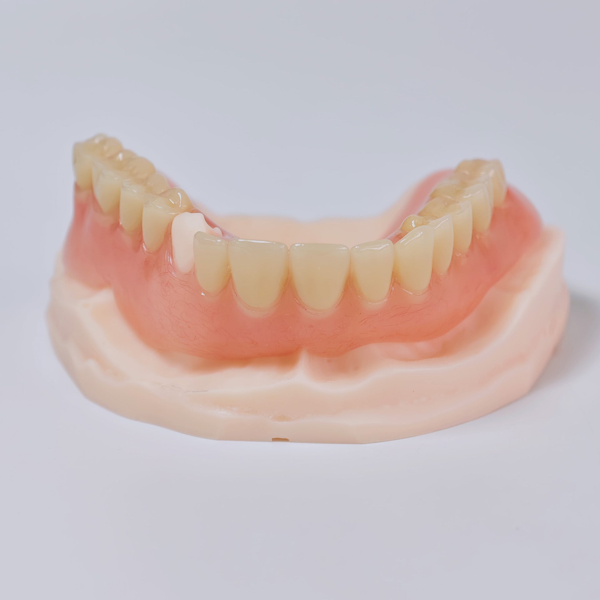 Acrylic Denture Resin Teeth Affordable Full Acrylic Denture