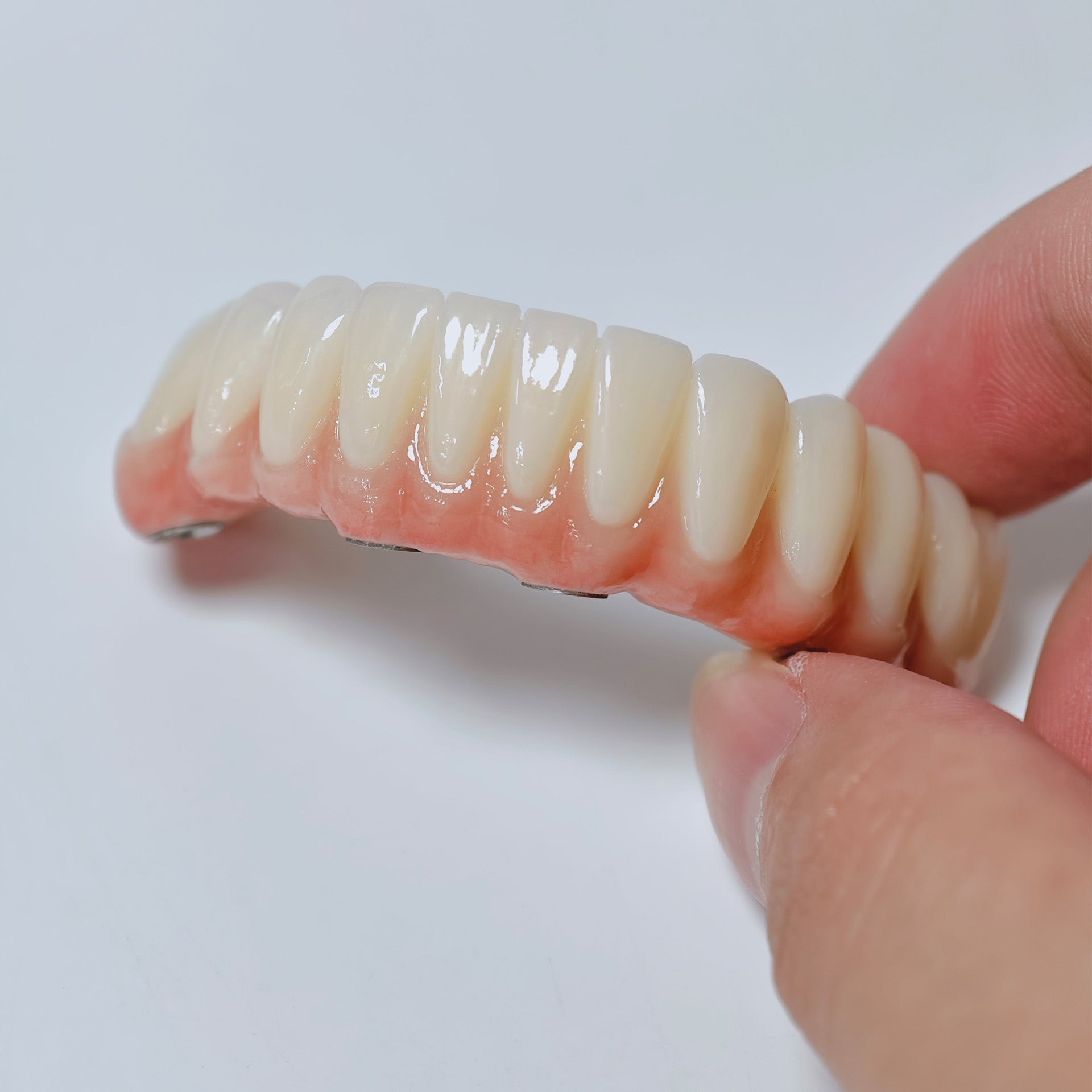 All On 4 Zirconia Bridge With Ti-Base Screw Retained