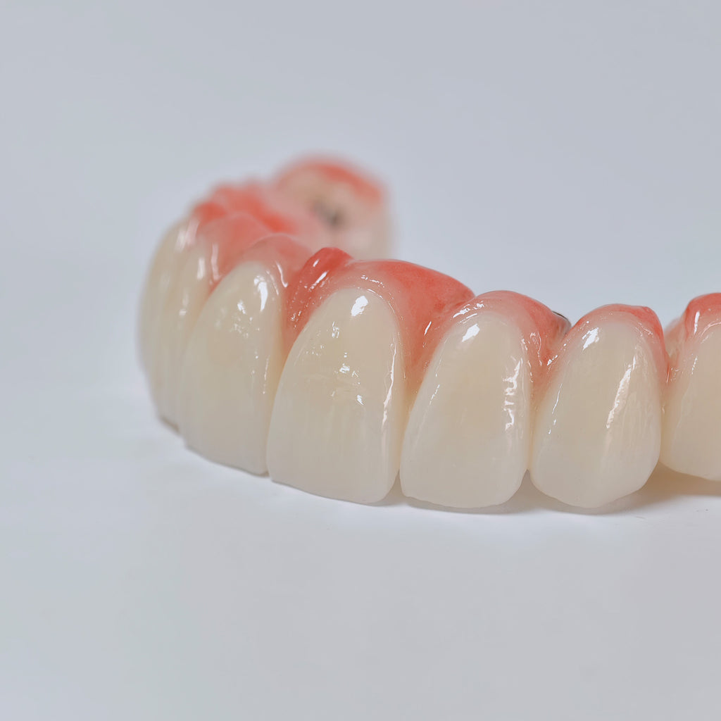 All On 6 Zirconia Bridge With Ti-Base Screw Retained