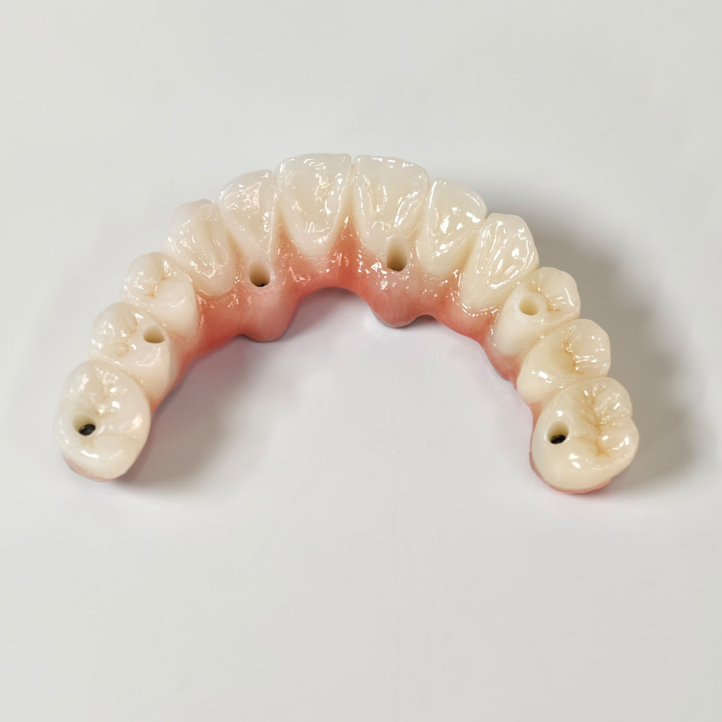 All On 6 Zirconia Bridge With Ti-Base Screw Retained