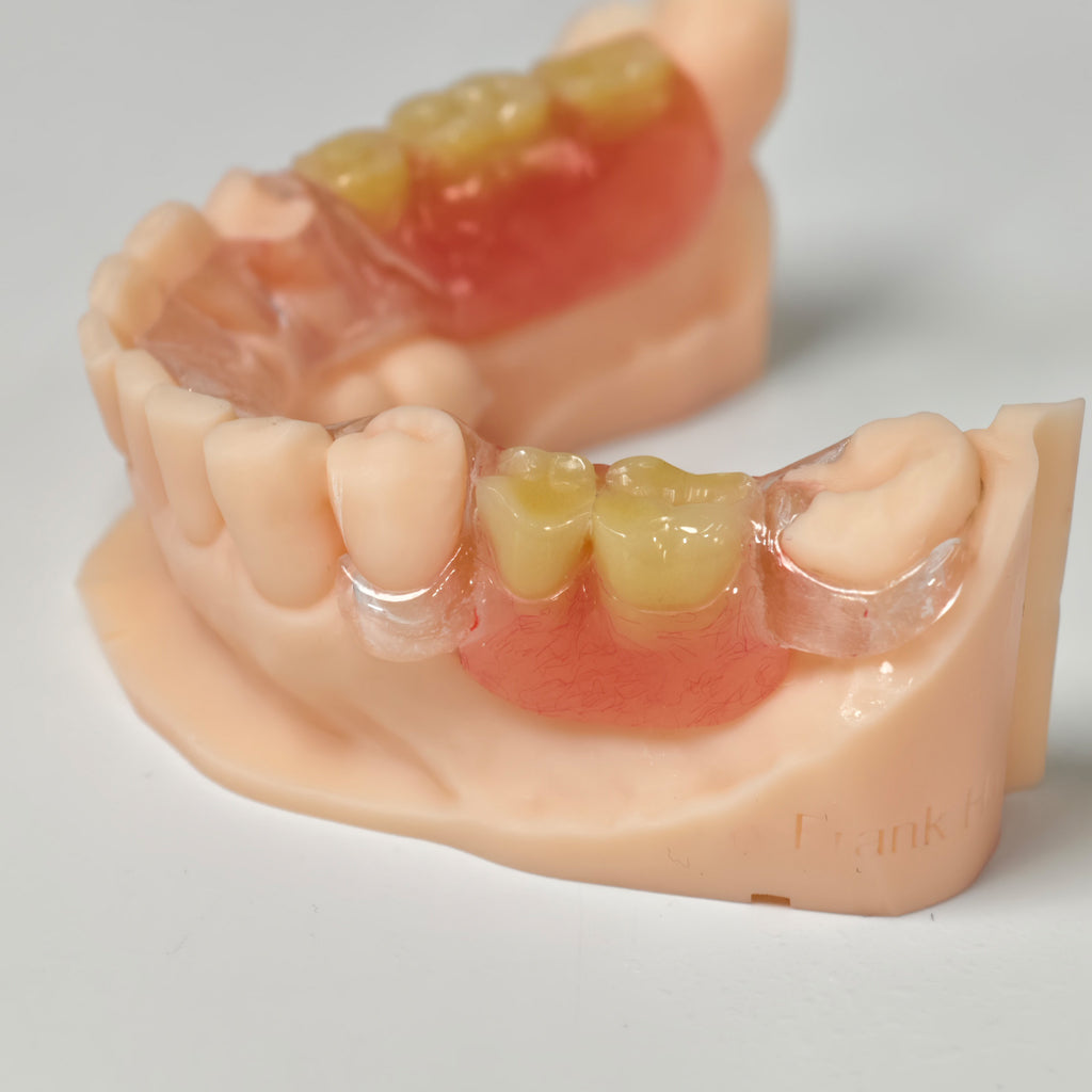Clear Framework With Acrylic Denture Aesthetic Denture
