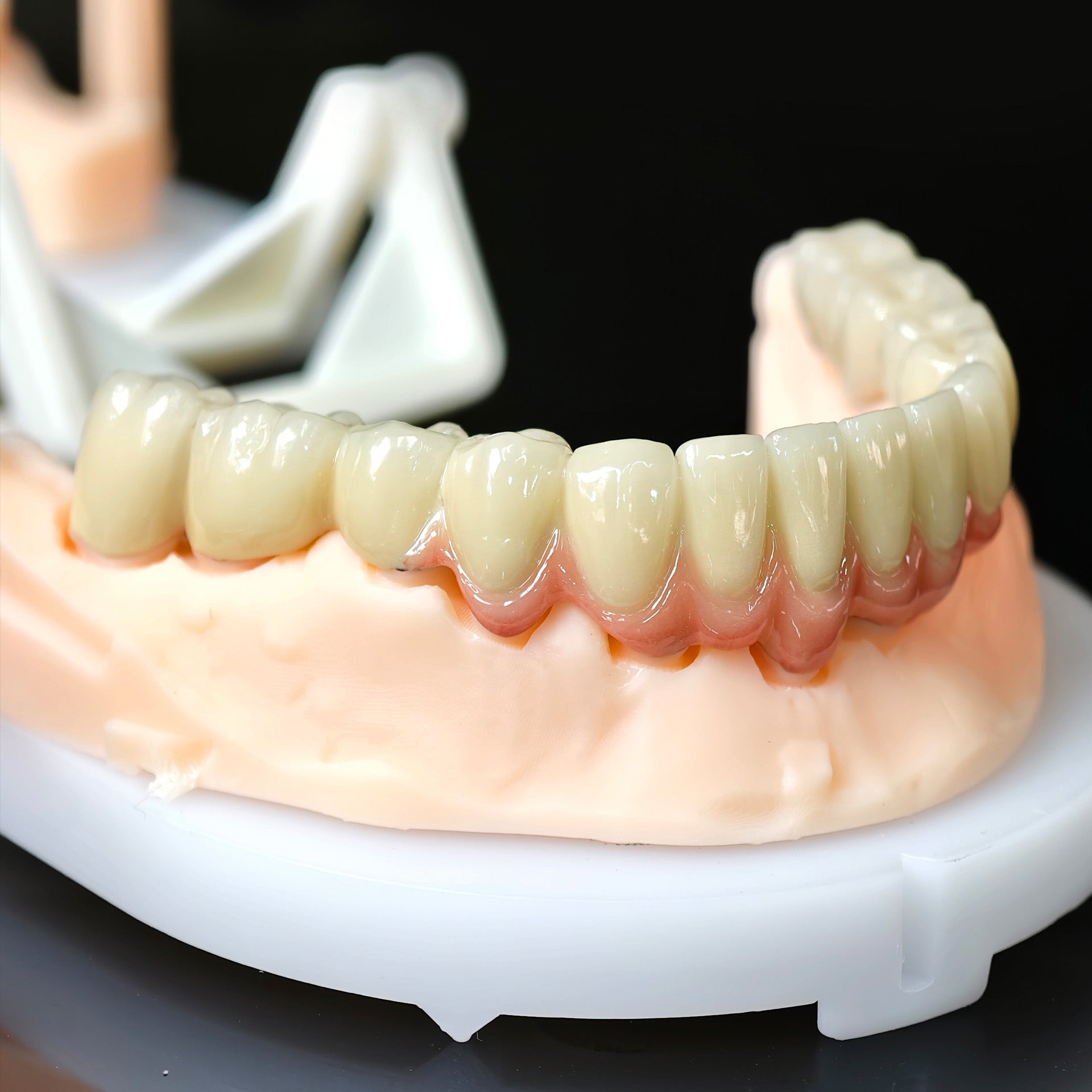 Co - Cr PFM Dental Bridge