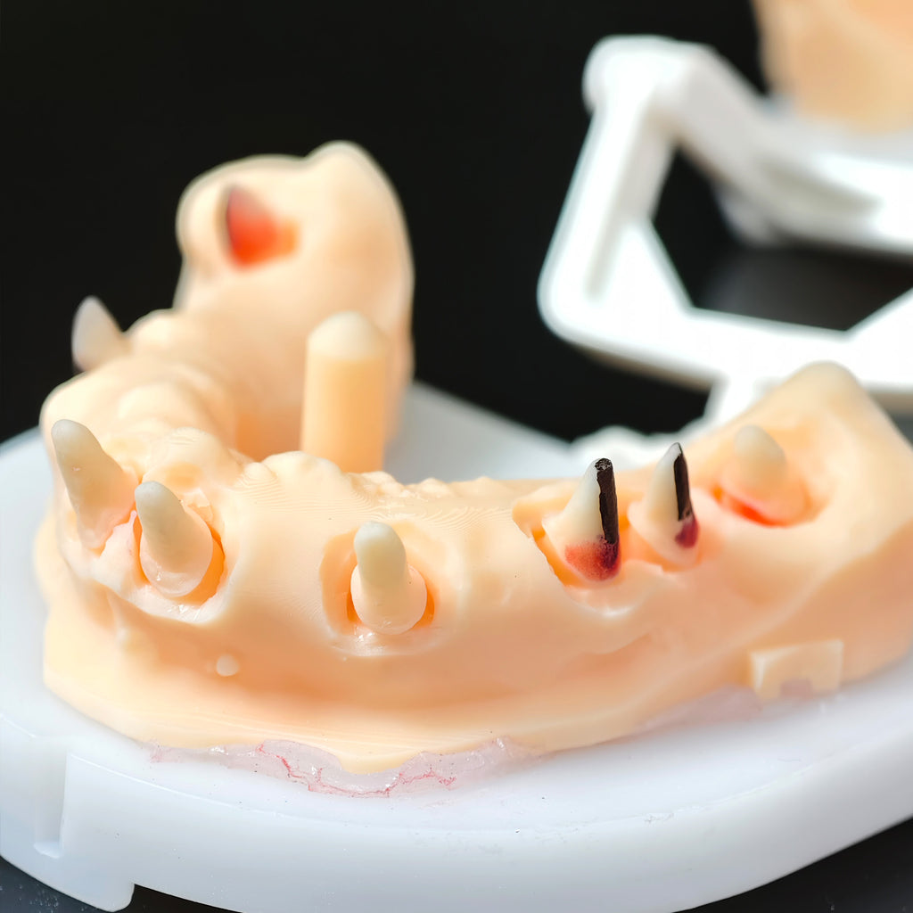 Co - Cr PFM Dental Bridge
