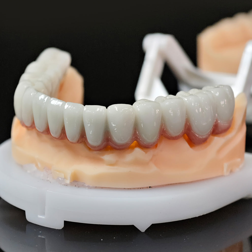 Co - Cr PFM Dental Bridge