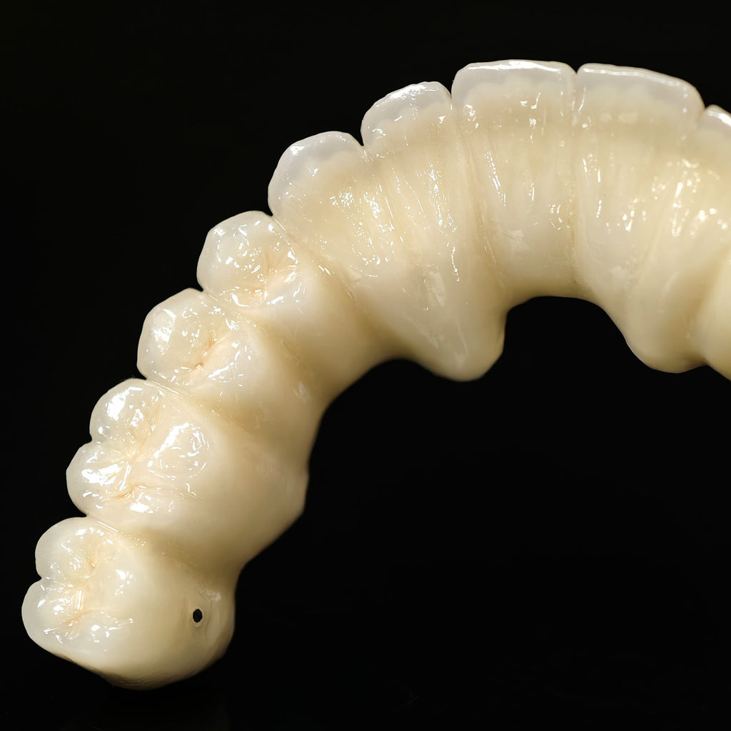 Co - Cr PFM Dental Bridge