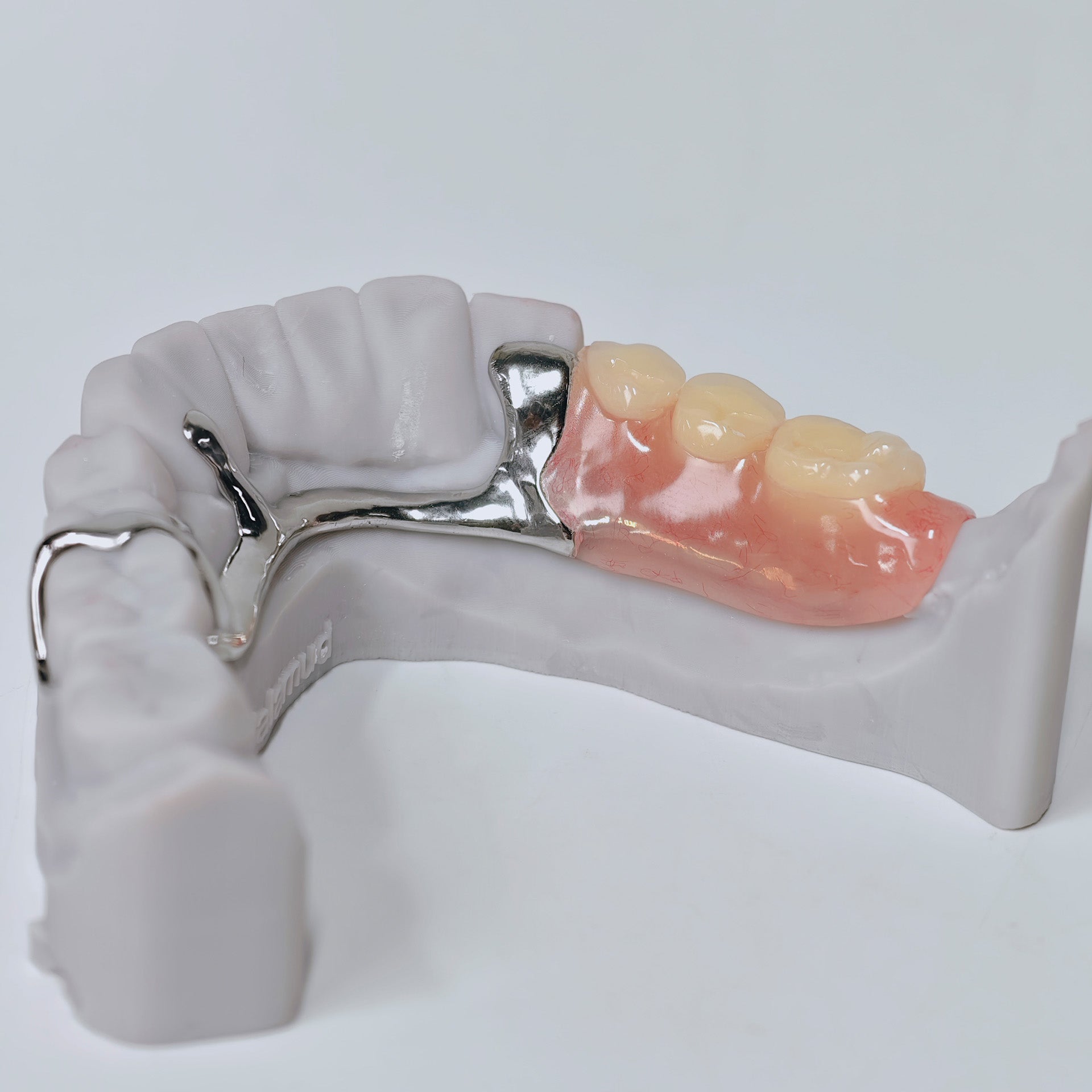 Cobalt Chrome Framework Denture Metal Framework With Acrylic Denture