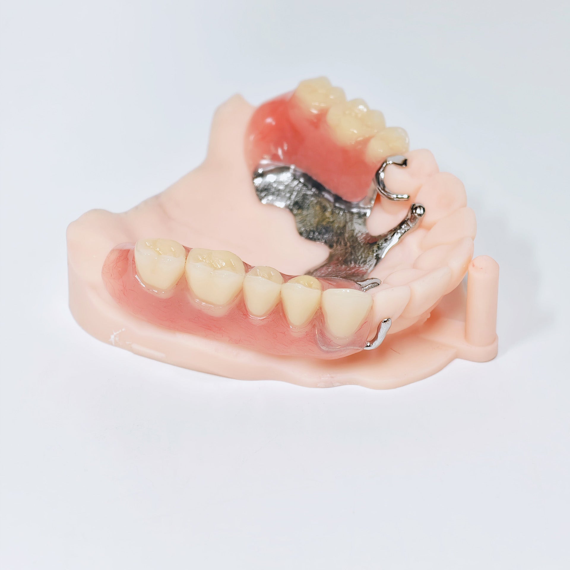 Cobalt Chrome Framework Denture Metal Framework With Acrylic Denture