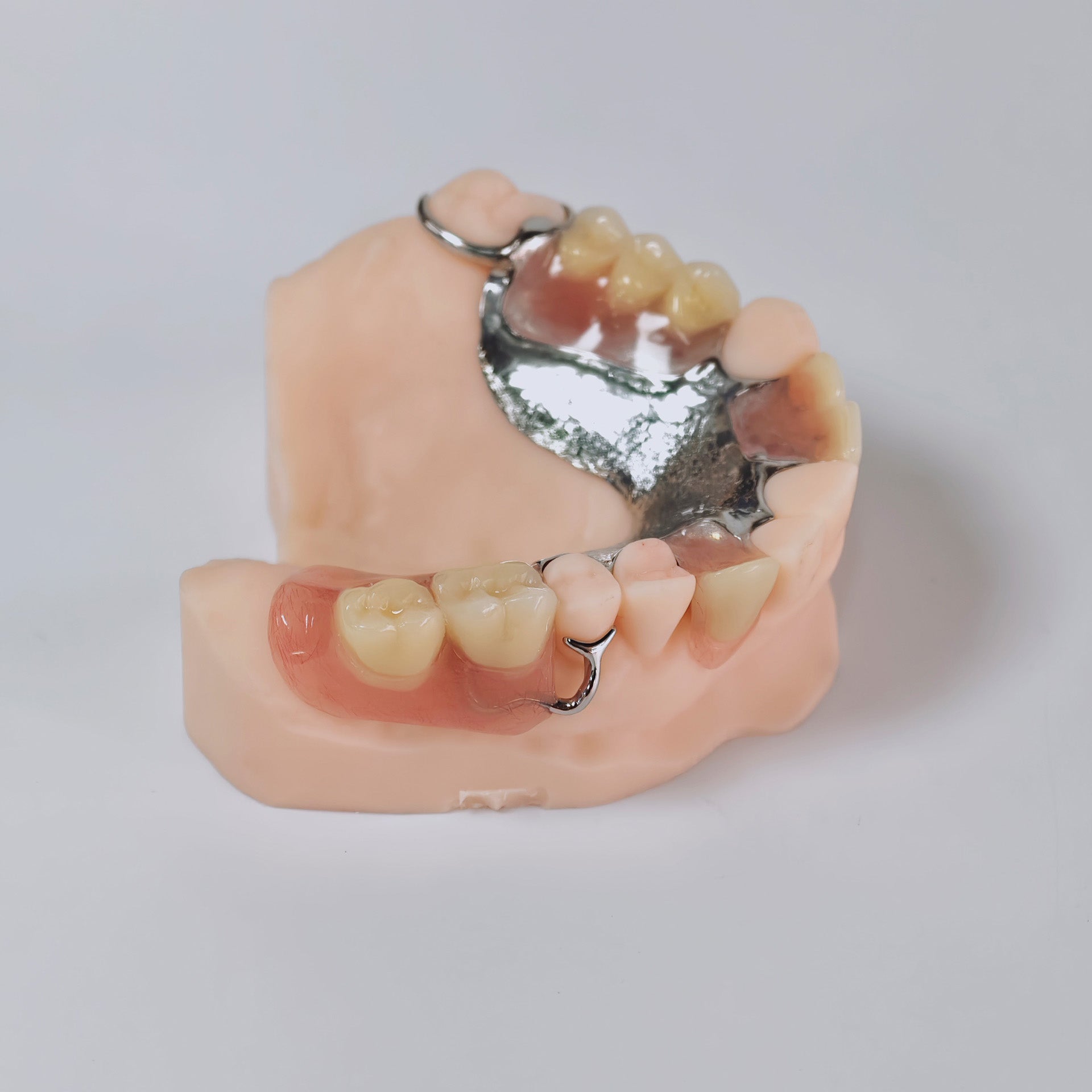Cobalt Chrome Framework Denture Metal Framework With Acrylic Denture