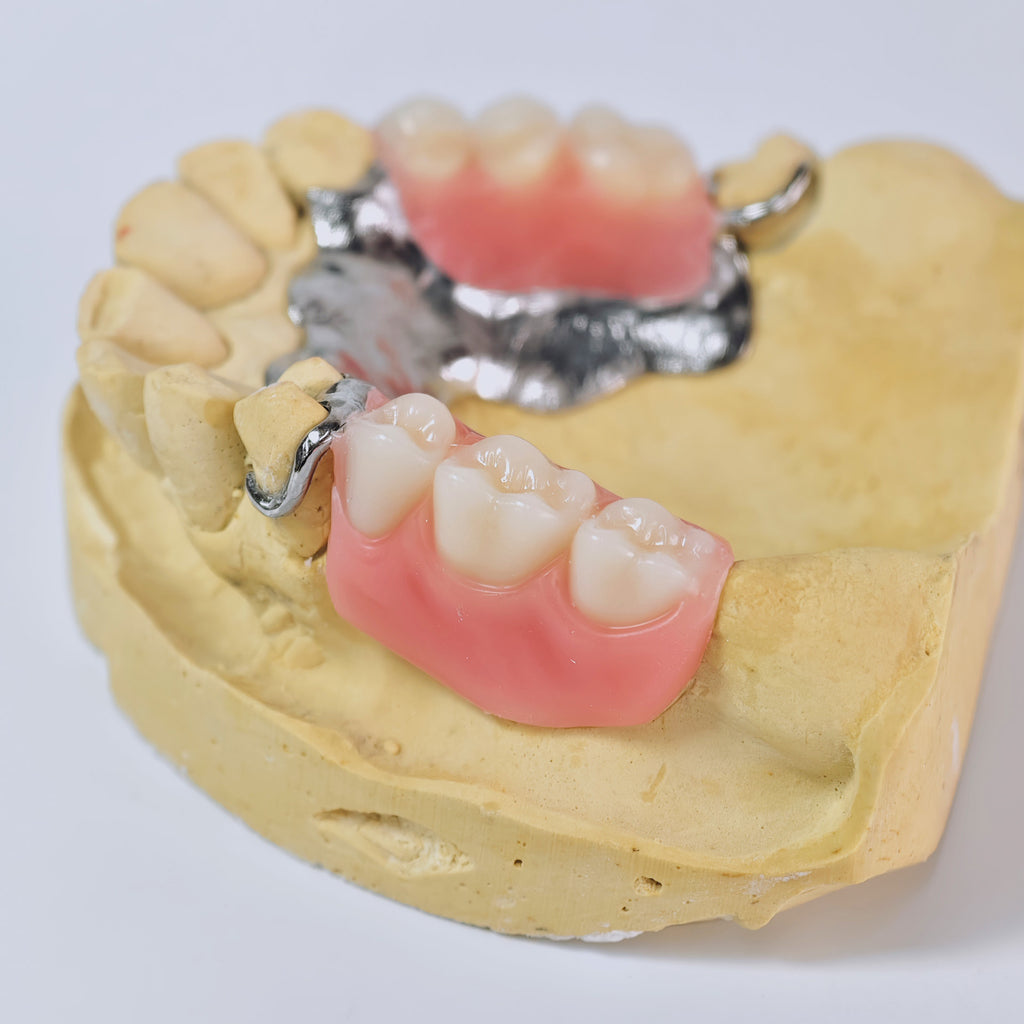 Cobalt Chrome Framework Denture Metal Framework With Acrylic Denture