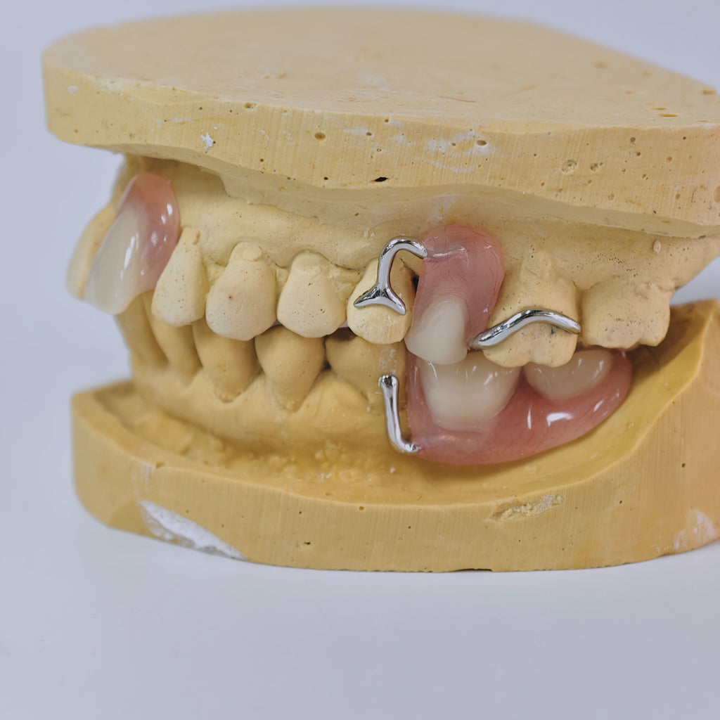 Cobalt Chrome Framework Denture Metal Framework With Acrylic Denture