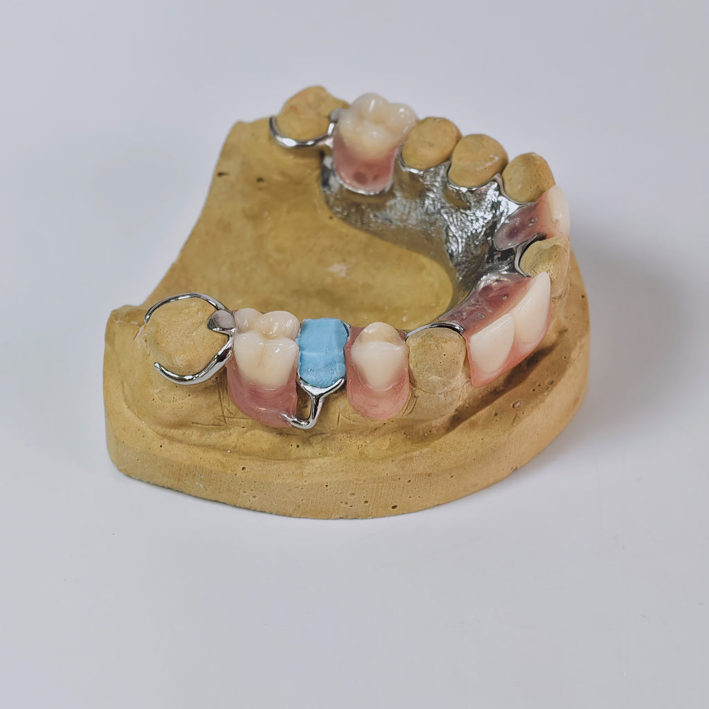 Cobalt Chrome Framework Denture Metal Framework With Acrylic Denture