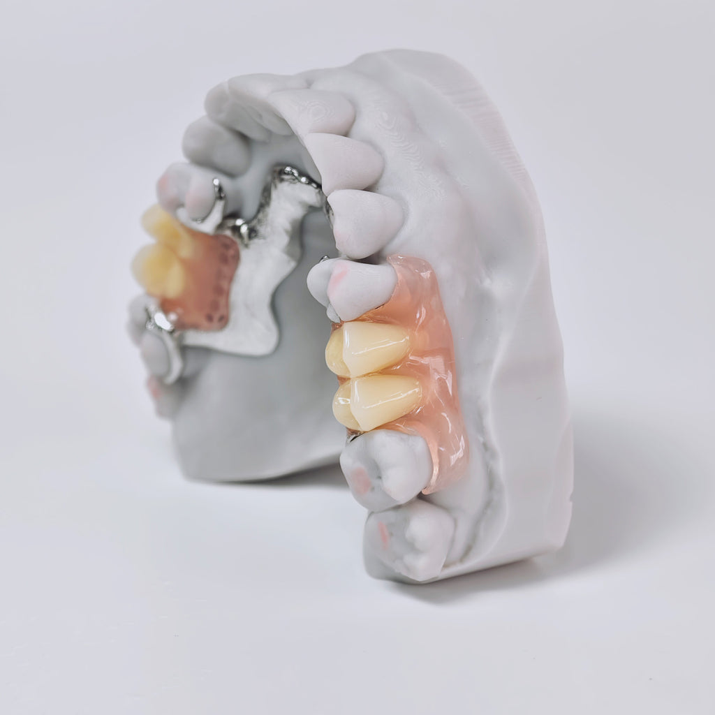 Cobalt Chrome Framework Denture Metal Framework With Acrylic Denture