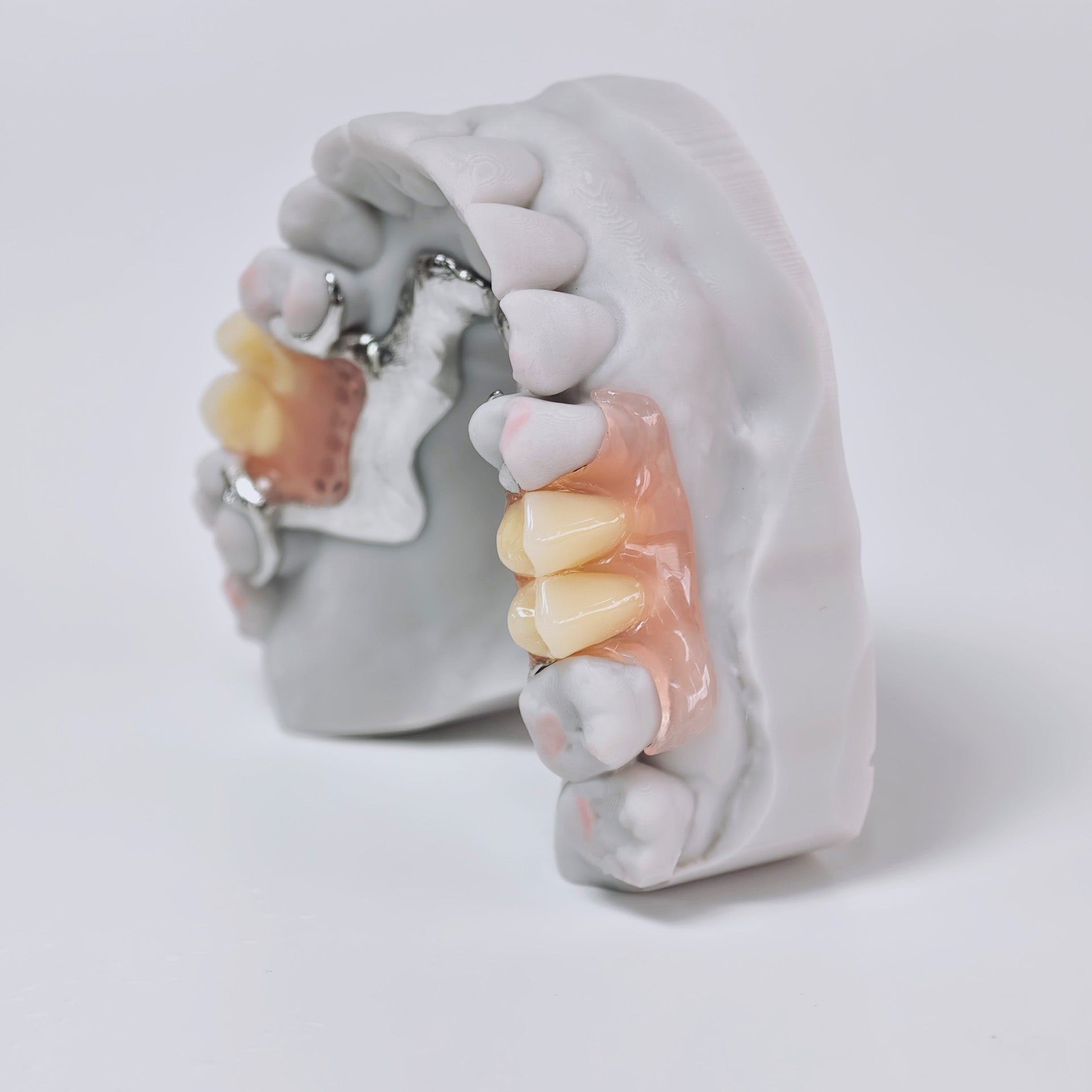 Cobalt Chrome Framework Denture Metal Framework With Acrylic Denture
