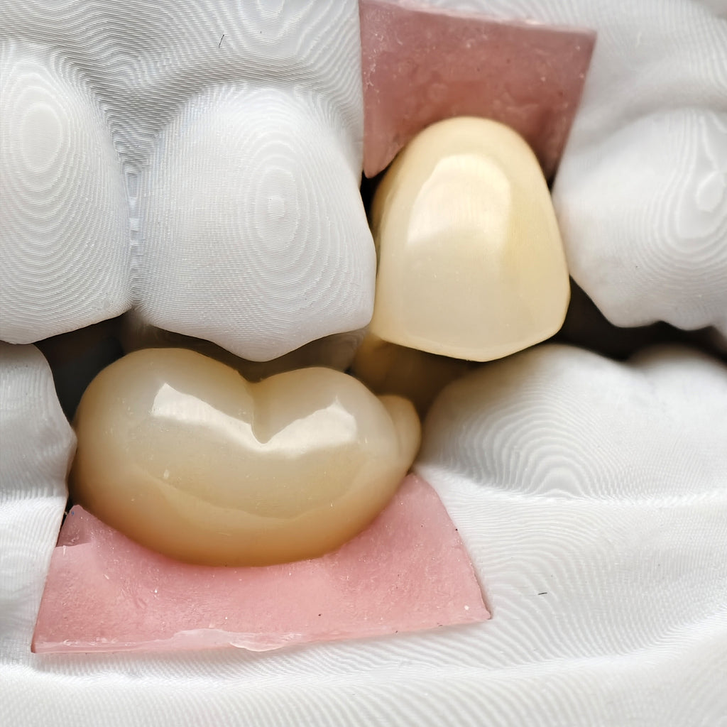 Custom Zirconia Implant Crowns