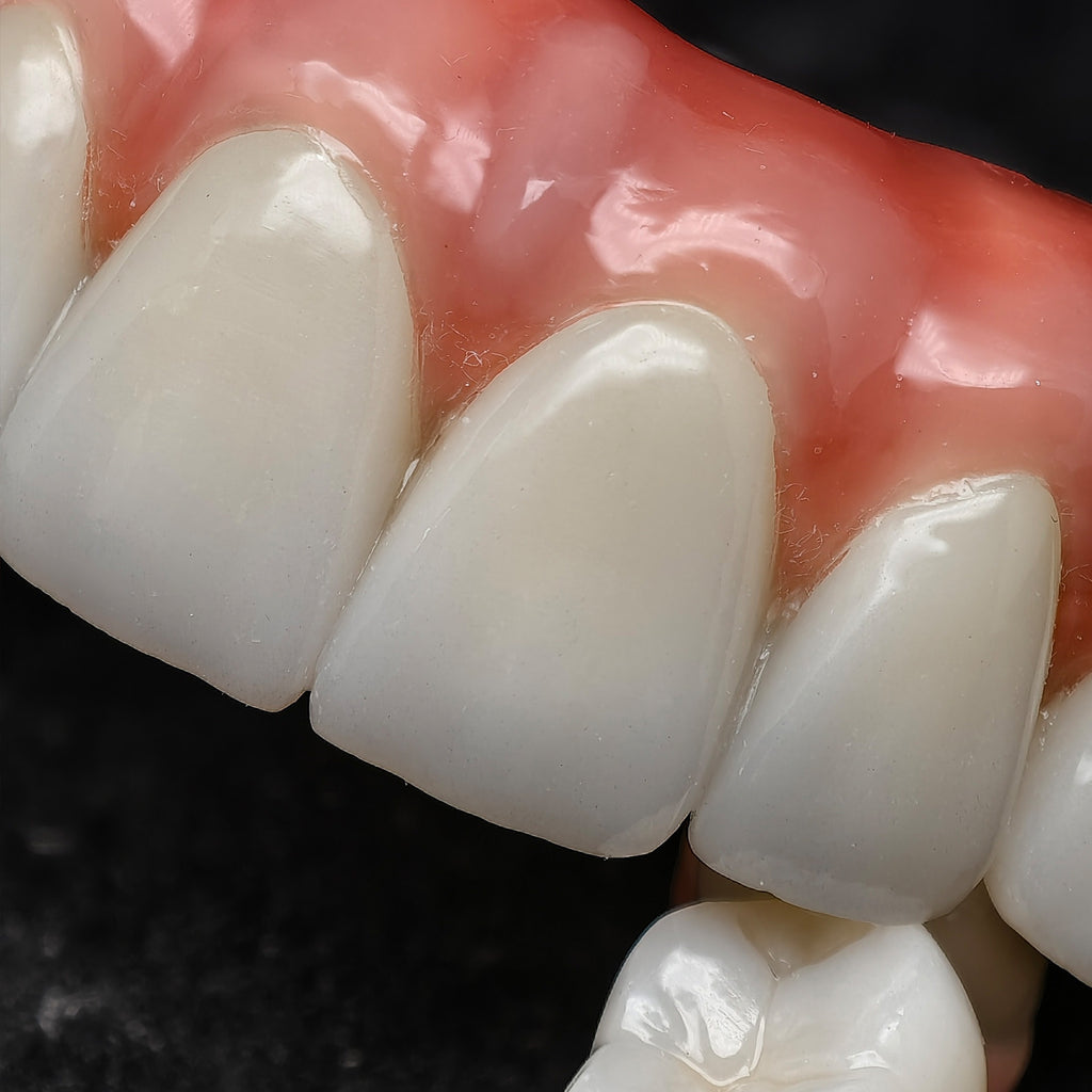 Enhanced Zirconia Crown Malo Bridge