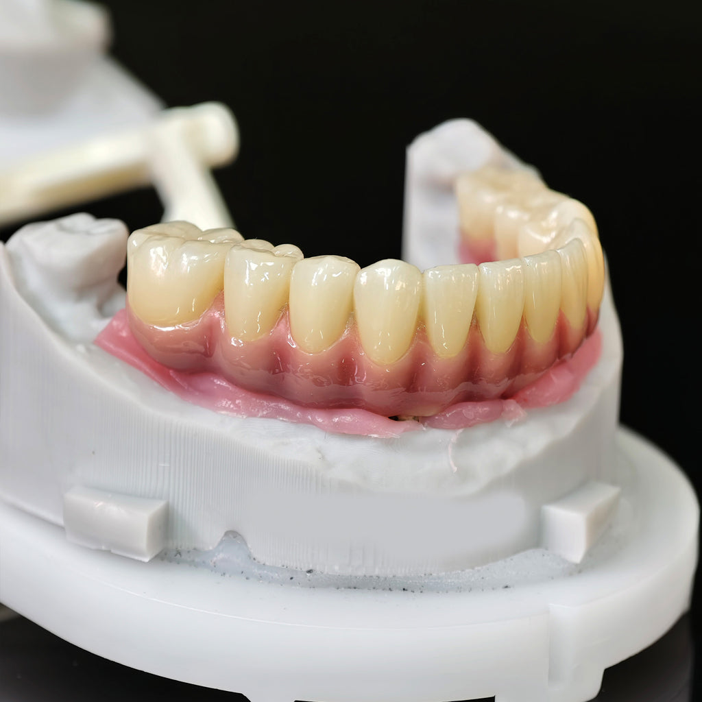 Enhanced Zirconia Crown Malo Bridge