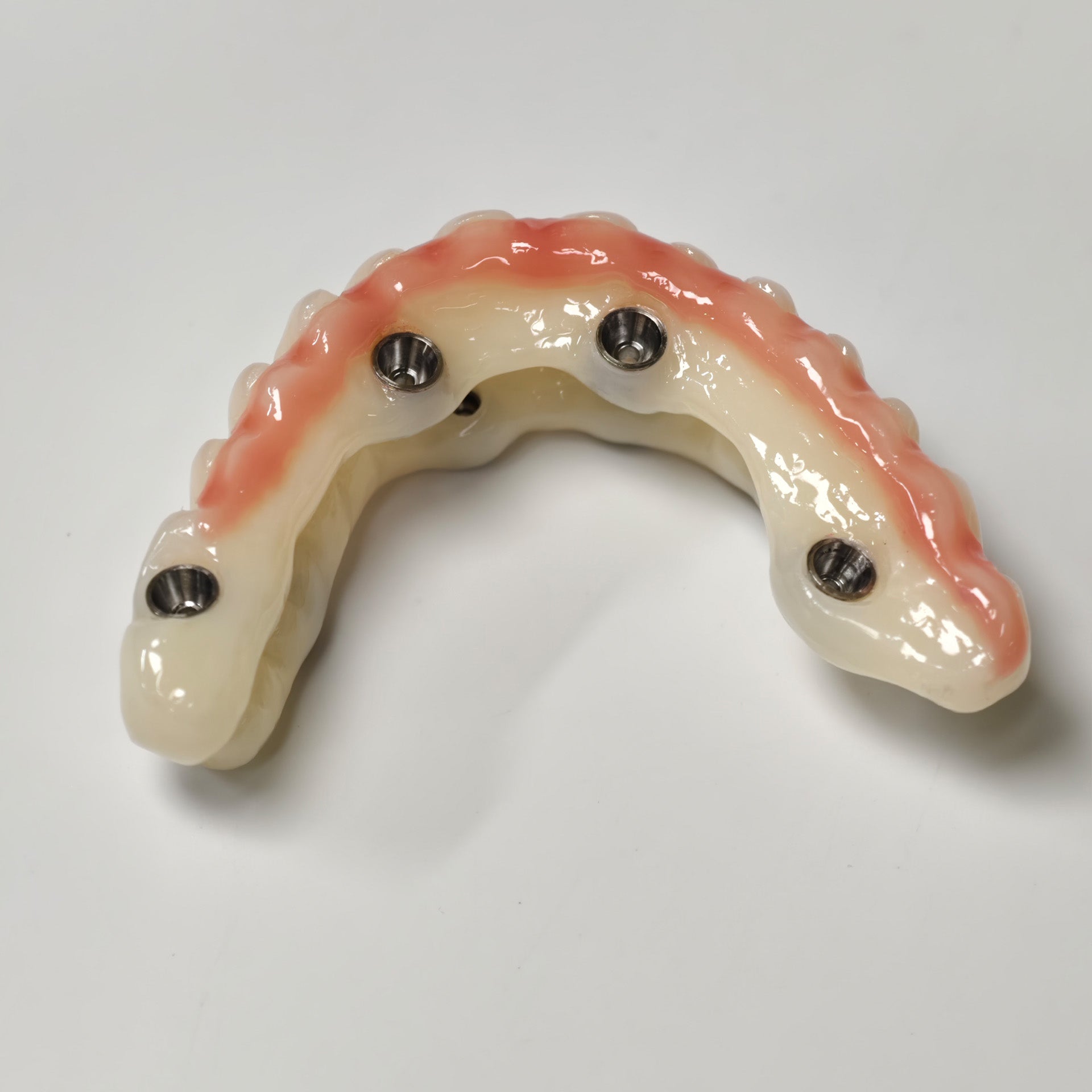 Full-Arch PMMA Bridge With Ti-Base Screw Retained