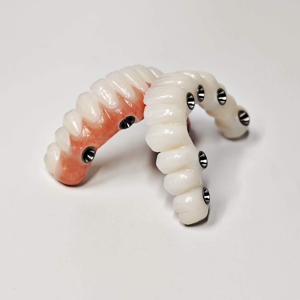 Full-Arch Zirconia Bridge With Ti-Base Abutment