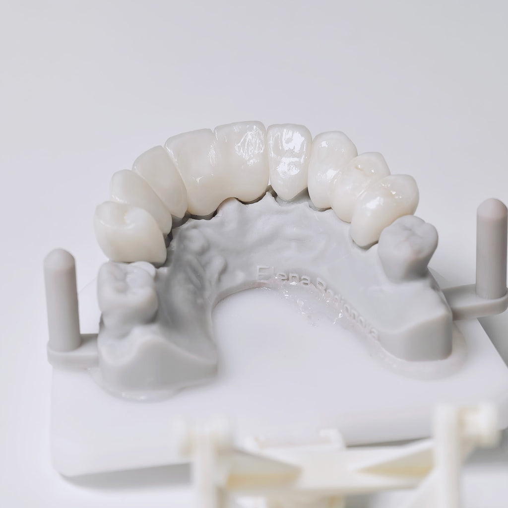 High - Strength Zirconia Bridge Aesthetic