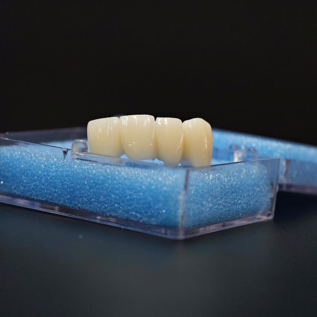 High - Strength Zirconia Bridge