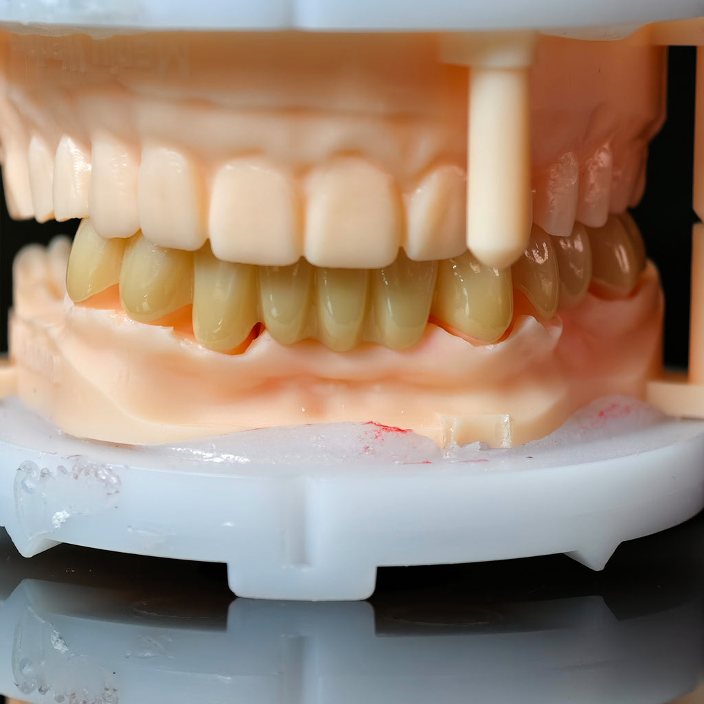 High - Strength Zirconia Bridge