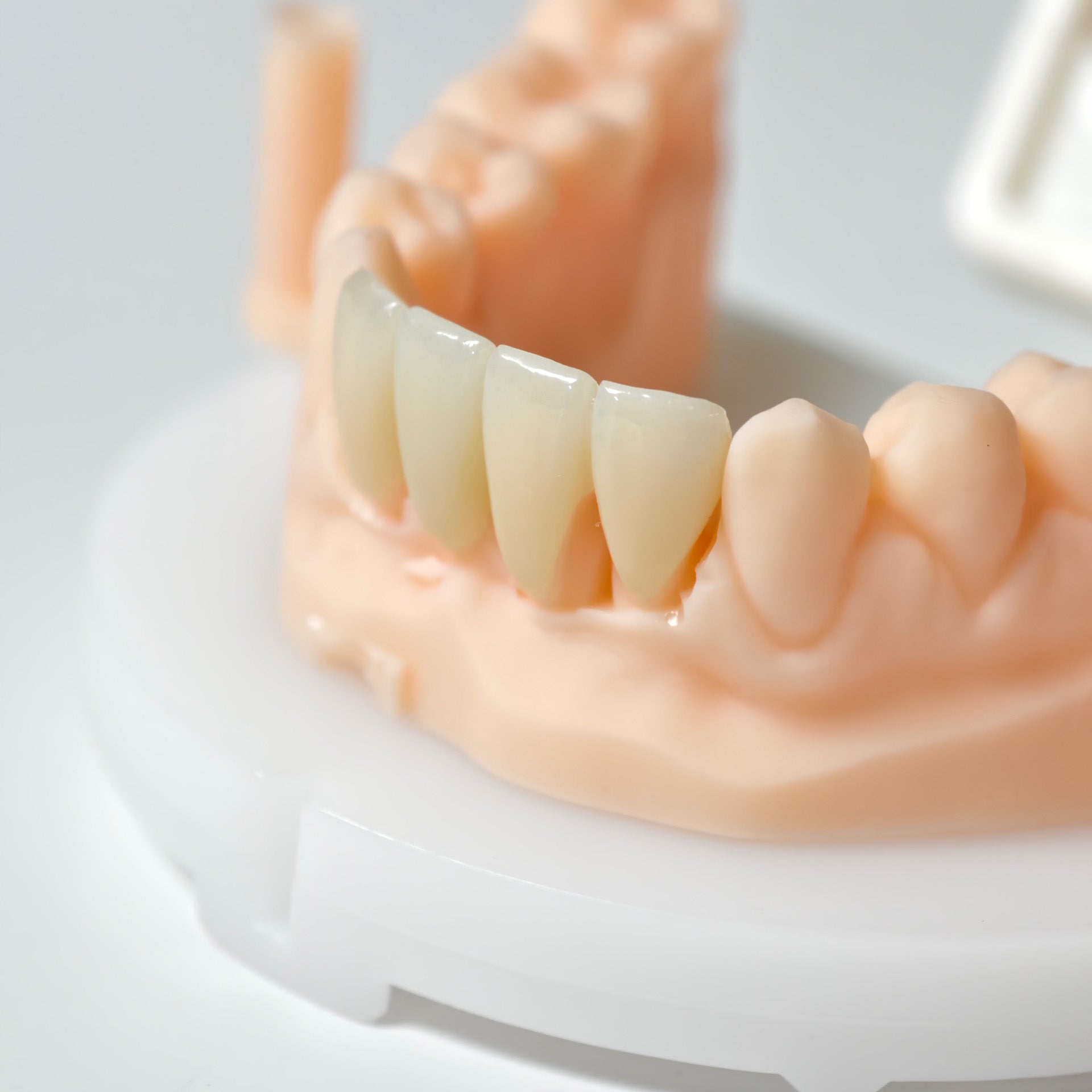 High - Strength Zirconia Bridge