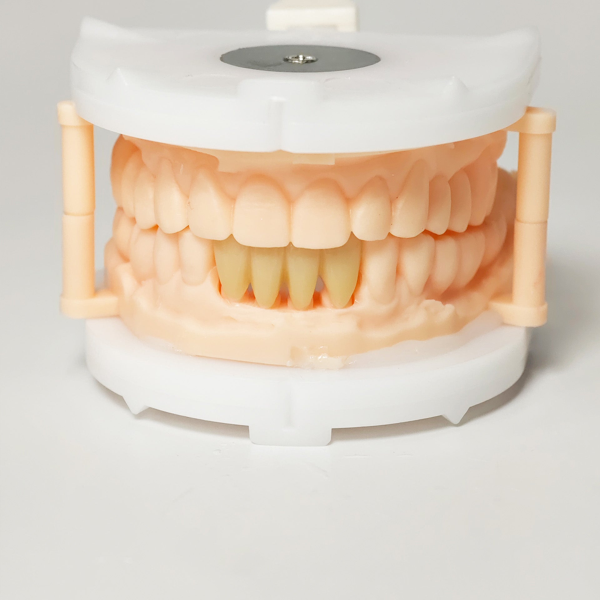 High - Strength Zirconia Bridge