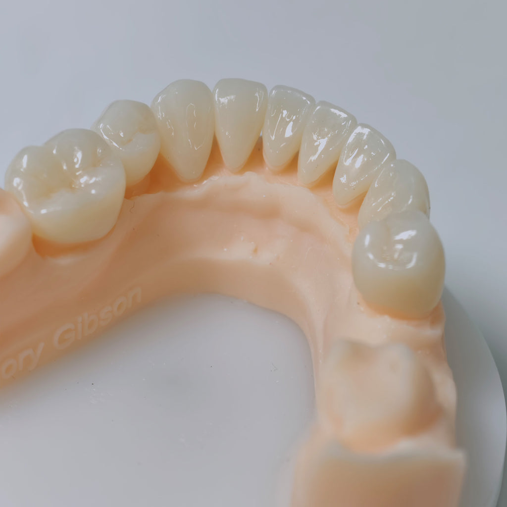 High - Strength Zirconia Bridge And Crown