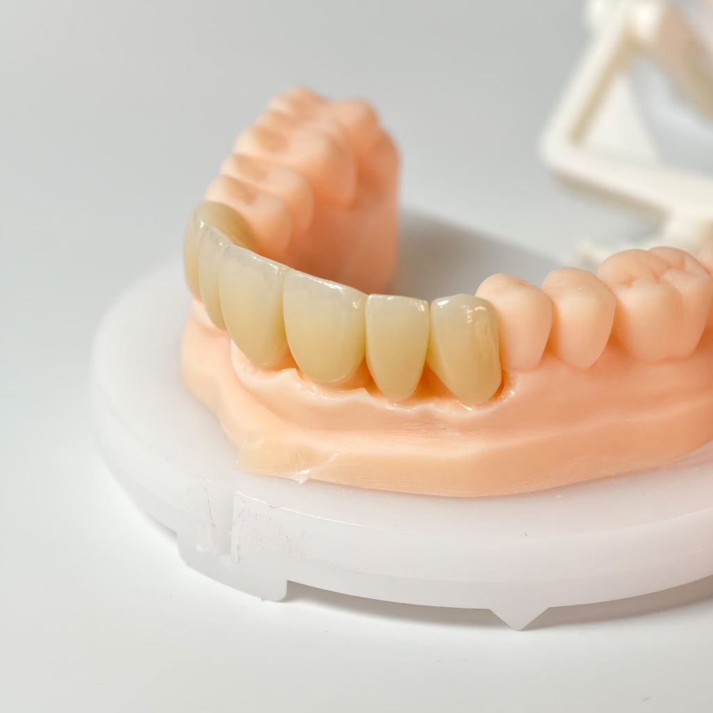 High - Strength Zirconia Bridge And Crown