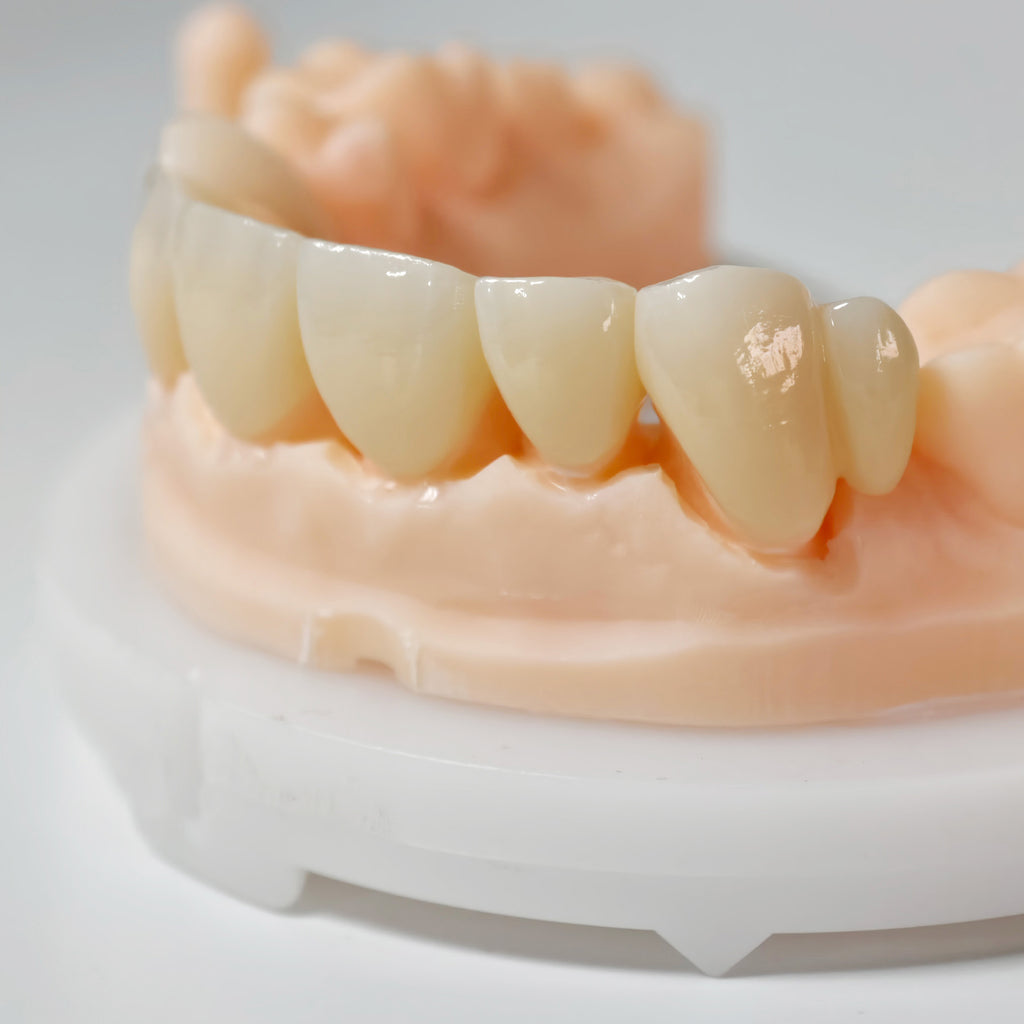 High - Strength Zirconia Crown