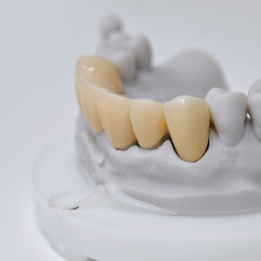 High - Strength Zirconia Crown And Bridge