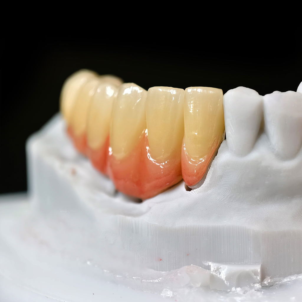 High - Strength Zirconia Crown And Bridge