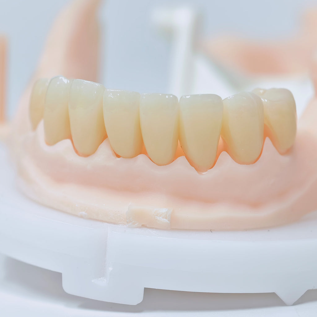 High - Strength Zirconia Crowns