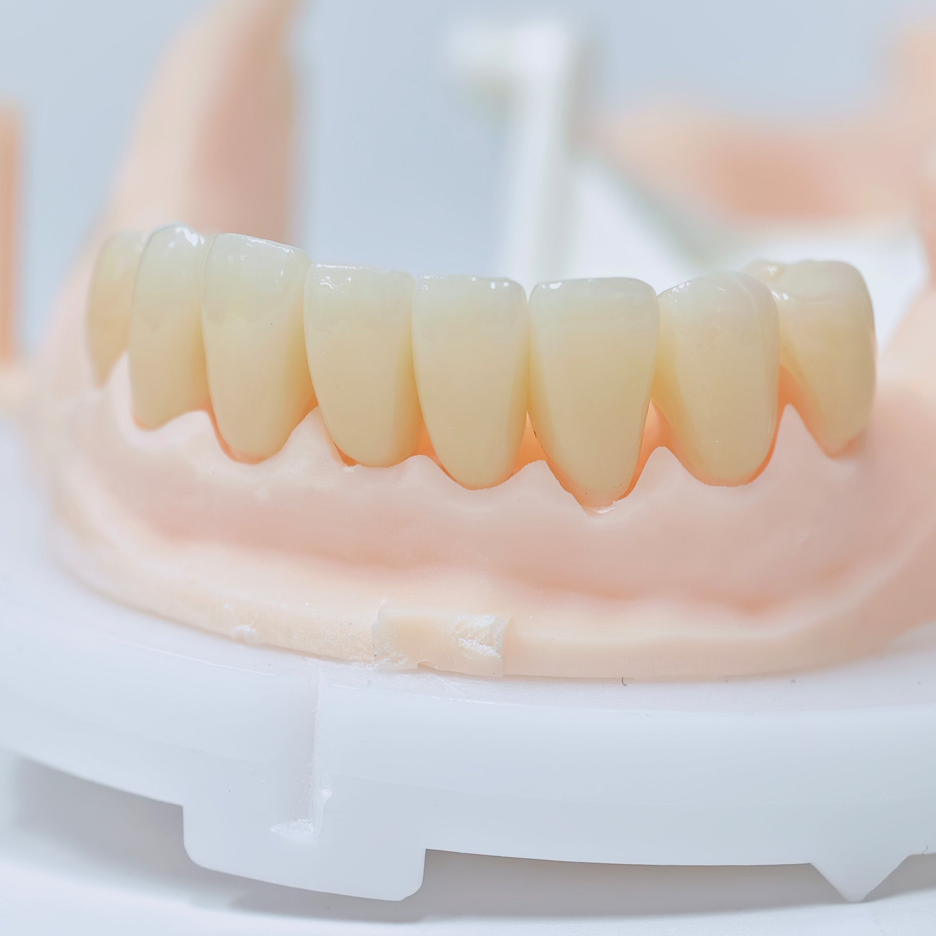 High - Strength Zirconia Crowns