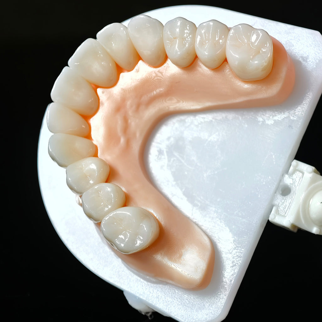 High - Strength Zirconia Crowns