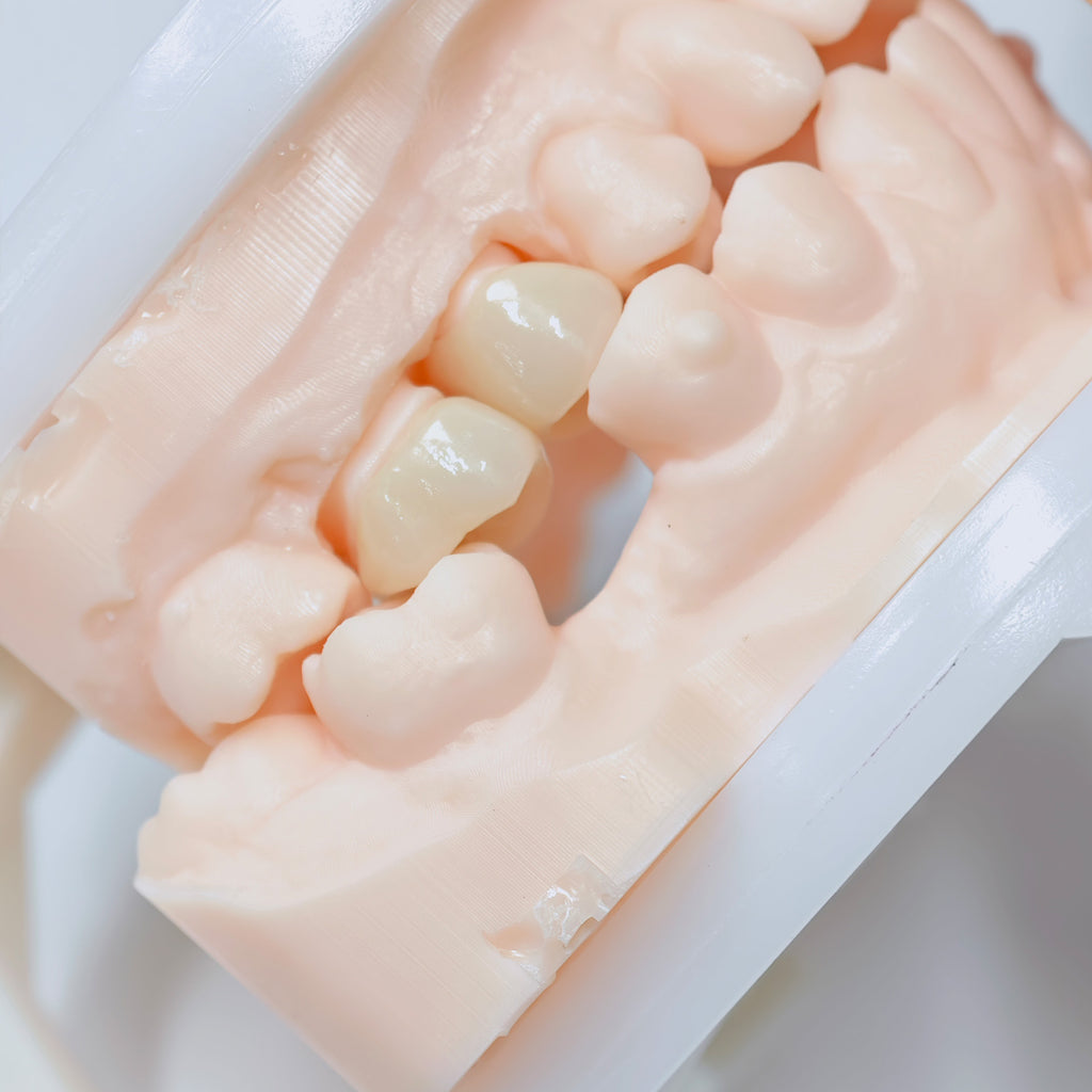 High - Strength Zirconia Crowns