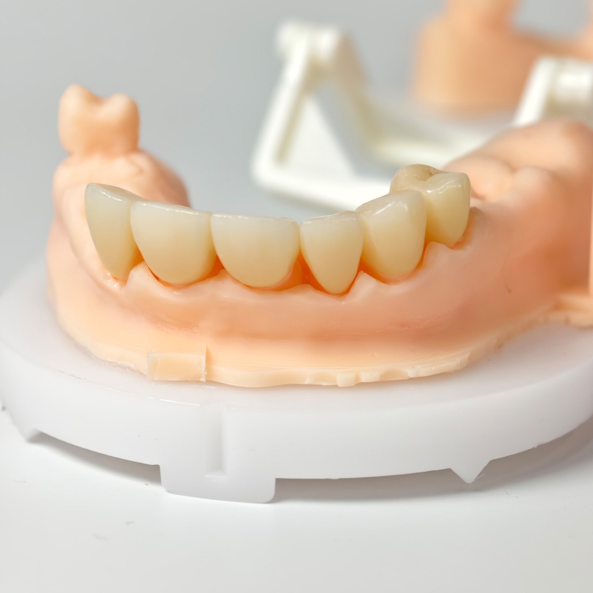 High - Strength Zirconia Crowns