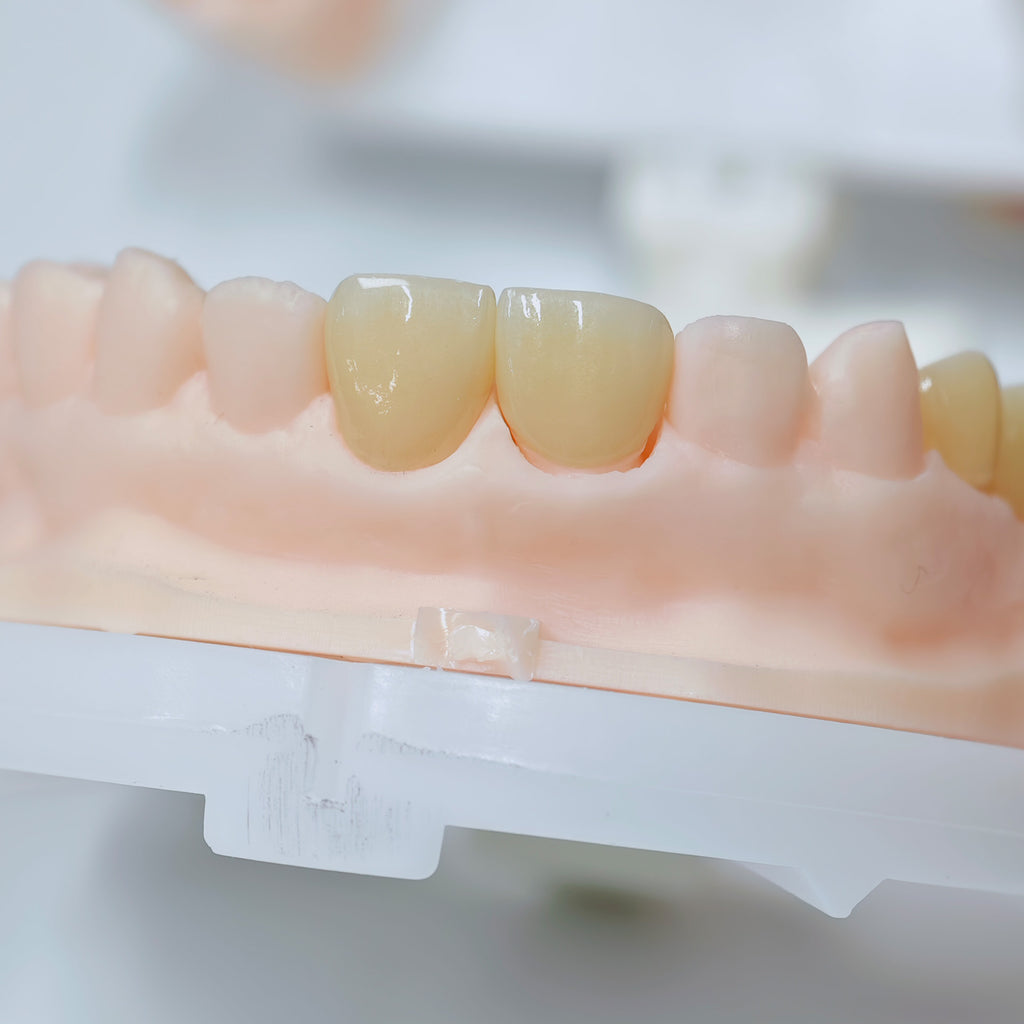 High - Strength Zirconia Crowns