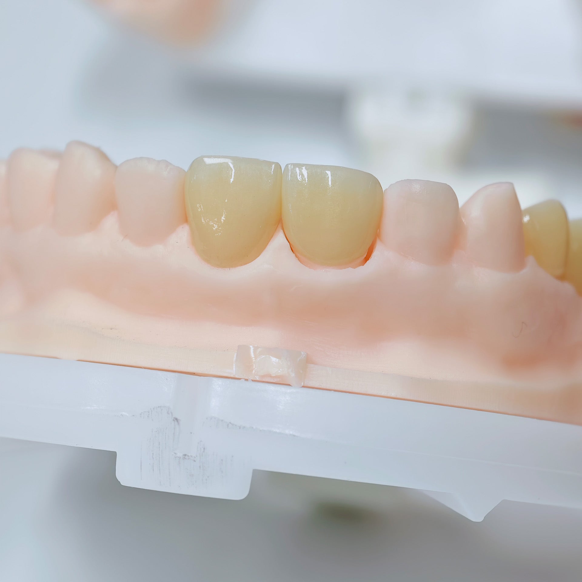 High - Strength Zirconia Crowns