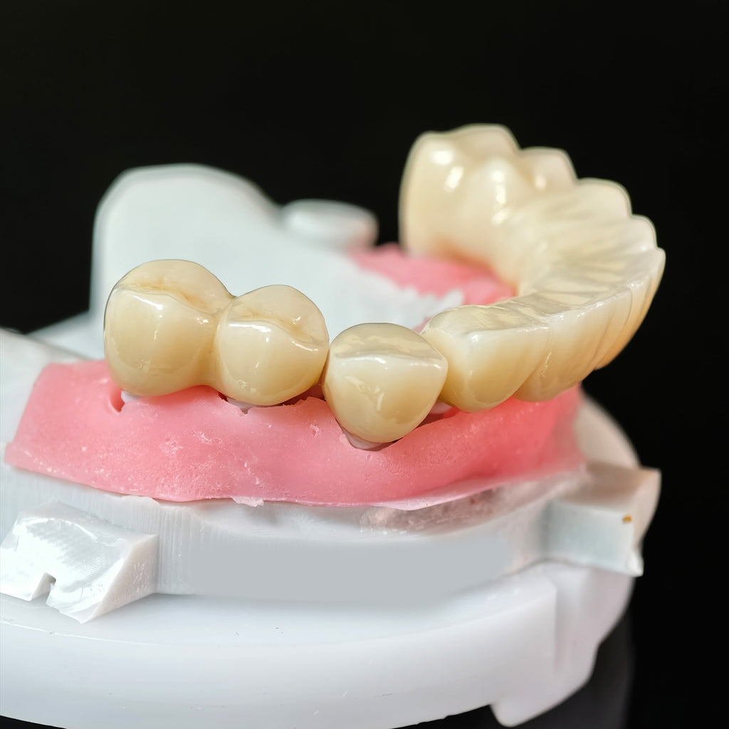 High - Strength Zirconia Crowns And Bridge