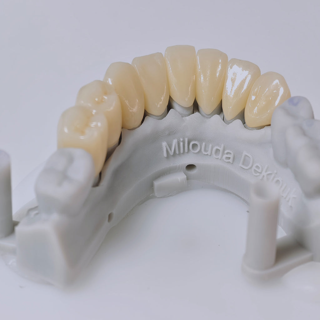 High - Strength Zirconia Crown with Post and core