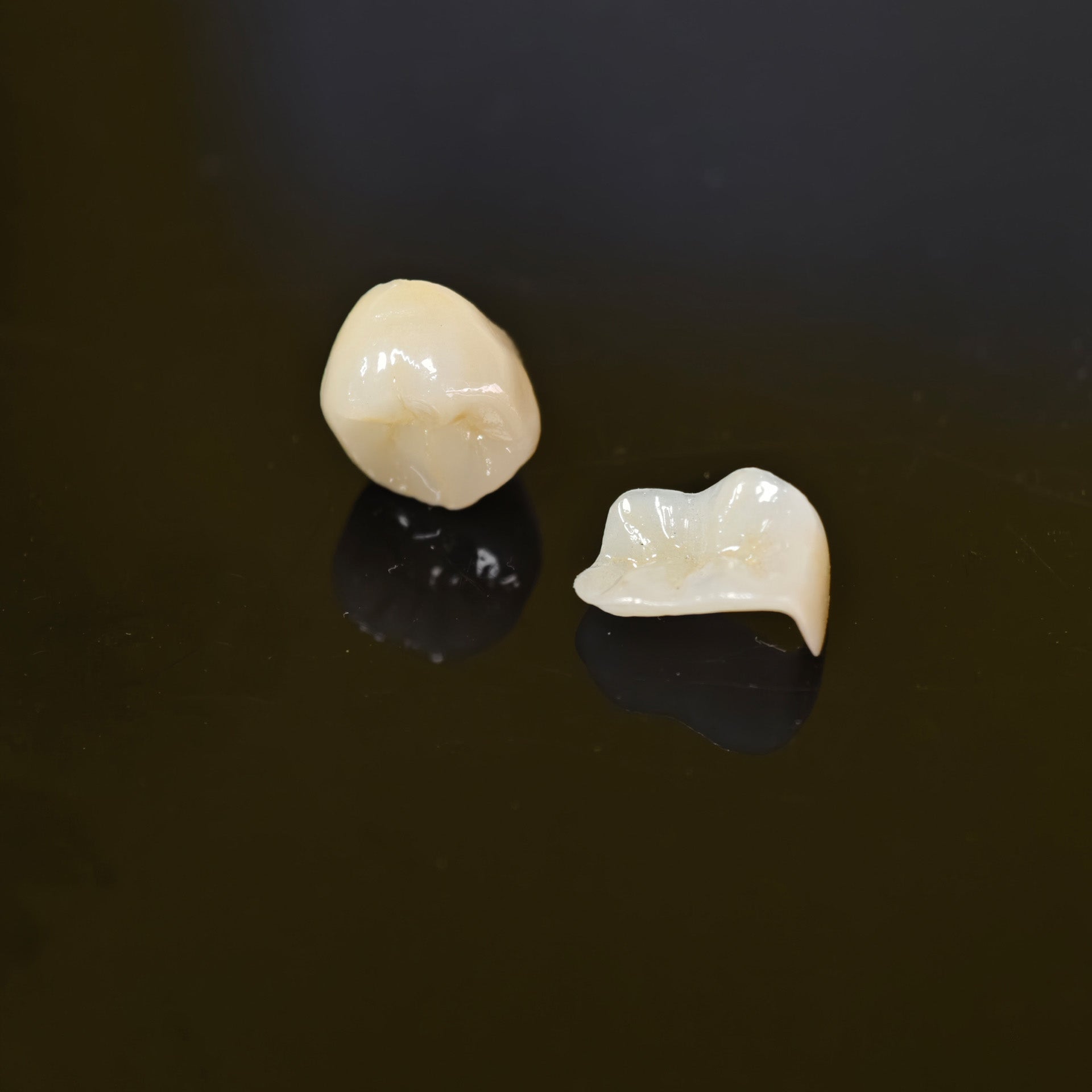 High - Strength Zirconia Inlay And Crown