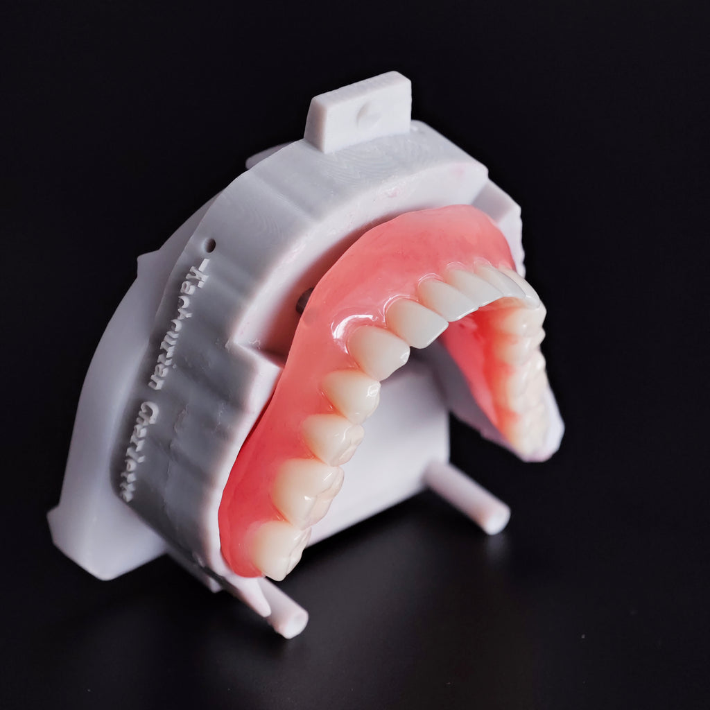 Locator Overdenture Implant Acrylic Denture Restoration