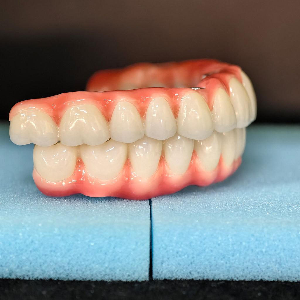 Malo Bridge Implant Restorations