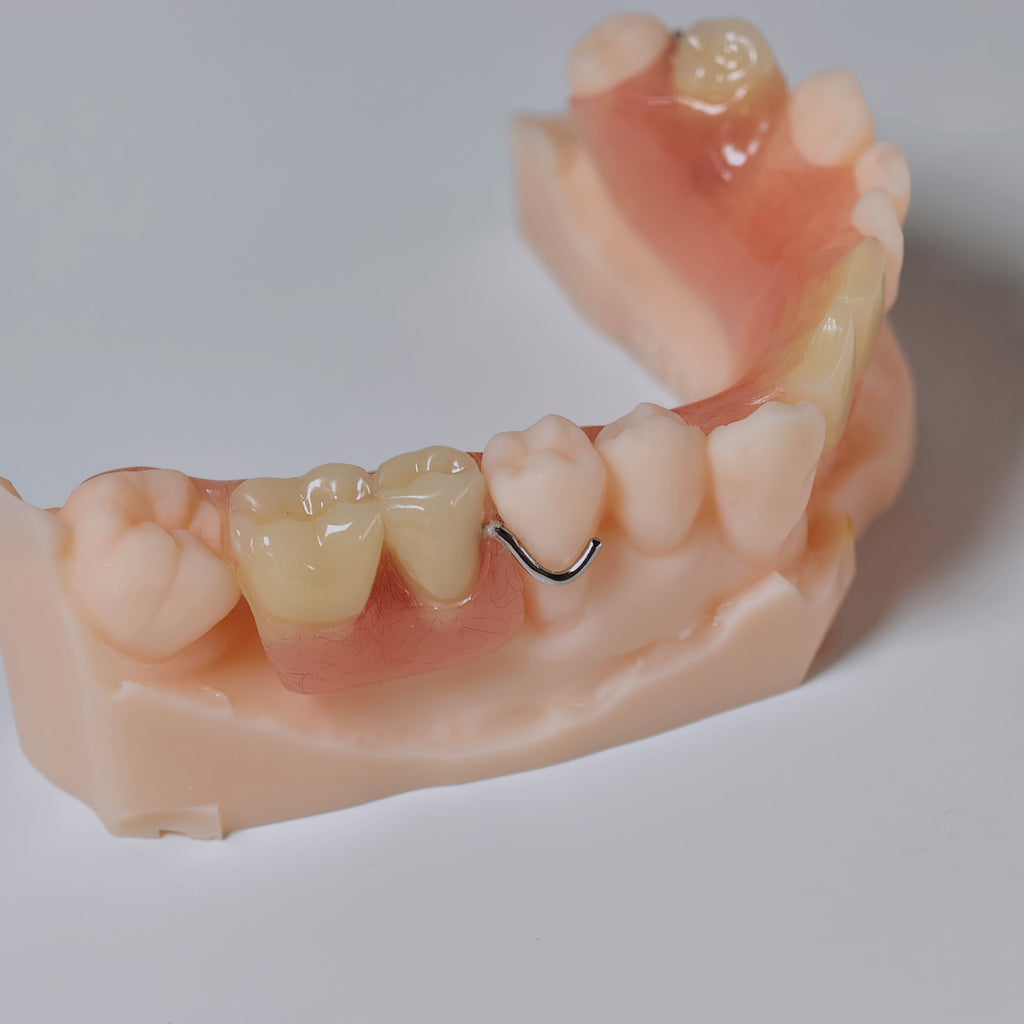 Metal Clasp Partial Denture