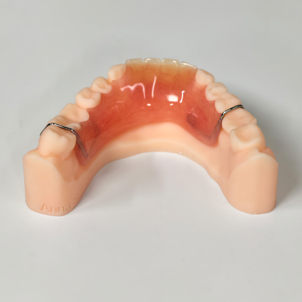 Metal Clasp Partial Denture