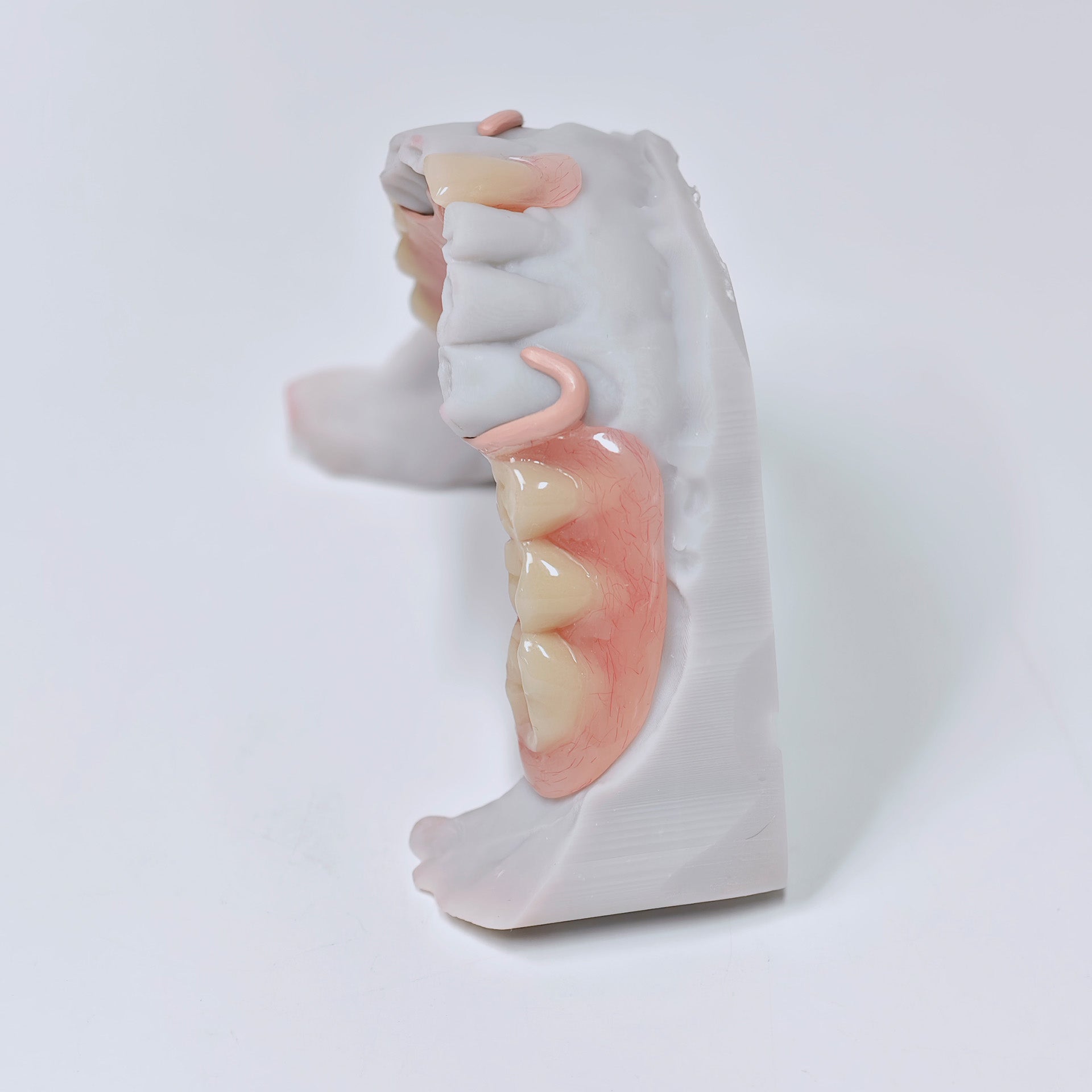 PEEK Framework Denture Metal Framework With Acrylic Denture